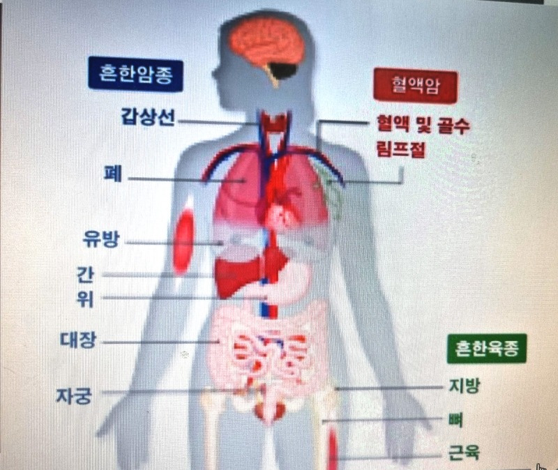 암 유병자01.jpg